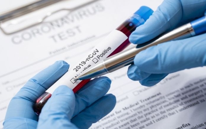 3568 са новите случаи на коронавирус у нас